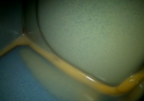 Huecos sellados en la cavidad