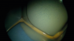 密封空腔中的缝隙